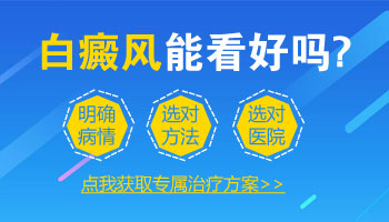 得了白癜风能看好吗 饮食上需要控制吗