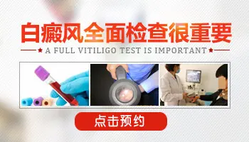 皮肤ct检查能查出白斑吗