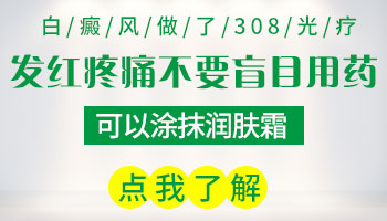 儿童面部白癜风做完308激光为什么红