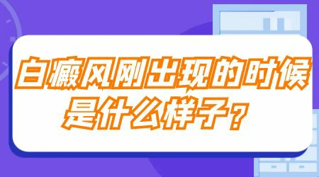 孩子身上长白斑是怎么回事 是白癜风吗