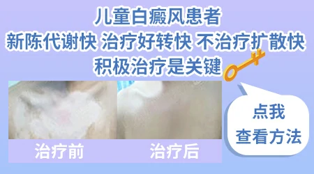 宝宝耳朵两侧对称发白