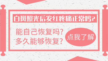 308准分子激光照完白斑发红是什么情况