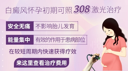 怀孕期间白癜风能继续治疗吗 药物对胎儿有影响吗