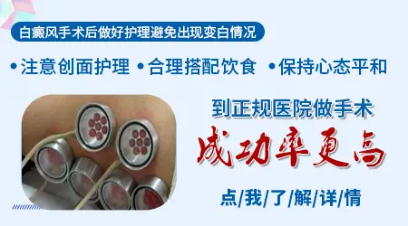 白癜风移植黑色素的费用