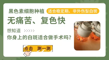 白癜风黑色素移植多久恢复正常皮肤