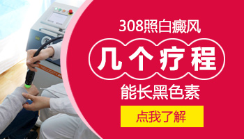 308激光治疗白癜风多长时间才开始长黑色素