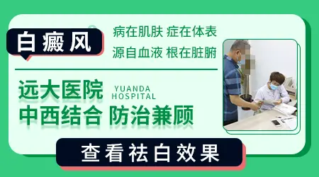 孩子头皮上一小块白斑照光能好吗