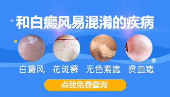 胸部和嘴唇有一些发白是得了白癜风吗