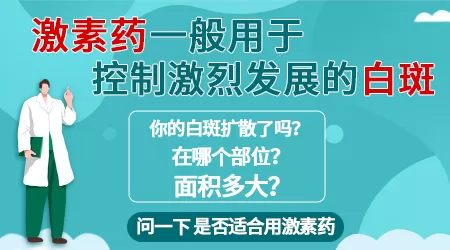 激素治白癜风还在发展怎么办