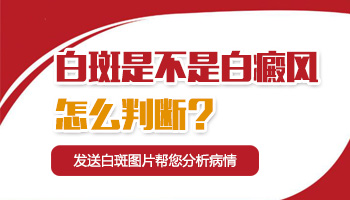 眼部有白斑如何判断是不是白癜风