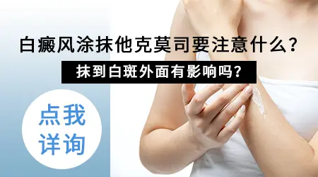 他克莫司软膏治白癜风多久能看到效果