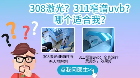 治疗白癜风308和311可以交替使用吗