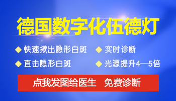 伍德灯检查一次白癜风是多少钱