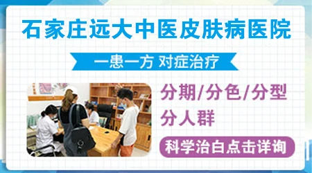 石家庄专治白癜风哪家医院好