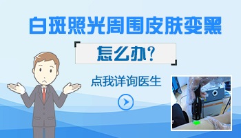 白癜风照光后皮肤会发黑吗