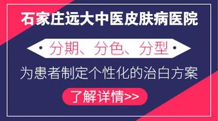 石家庄治白斑的医院 中医方法治疗皮肤白斑