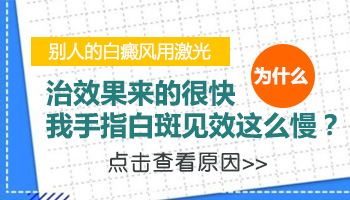 手指白癜风照311效果咋样