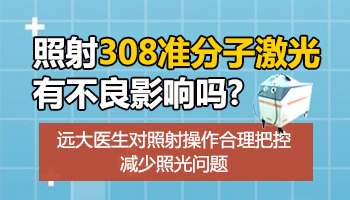 308准分子光治疗仪照白癜风对内脏有影响吗