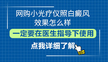 网上卖的白癜风治疗仪有用吗