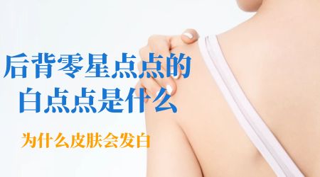 孕妇后背白色一片