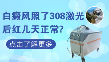 308激光打完白癜风一般红几天才正常