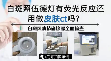 做了伍德灯还有必要再做皮肤ct吗