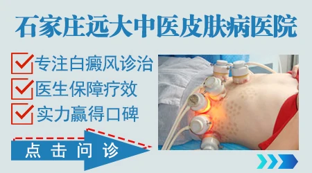 石家庄最好的皮肤病医院是哪家