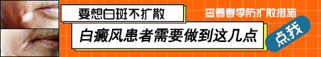 怎样能让白癜风不再扩散