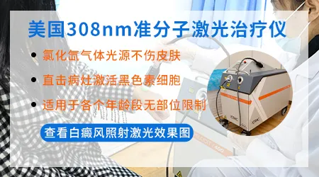 儿童白癜风光疗全身仓几岁可以做