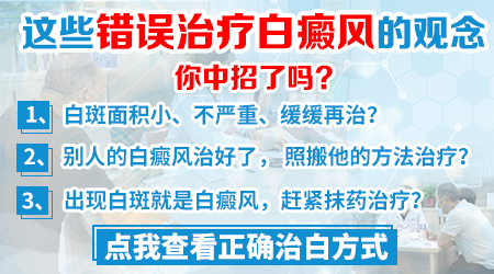 女性得了白癜风如何治疗比较好