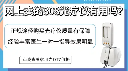 网上买的半岛308是真是假 家用白癜风光疗机