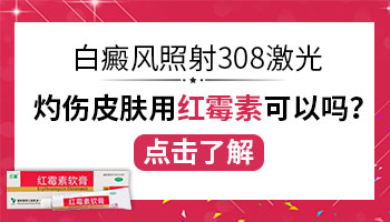 白癜风照光发红有点痒可以用红霉素涂吗