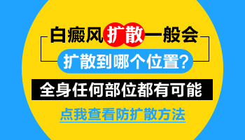 手部白癜风会向面部扩散吗