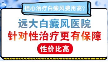 白癜风照光一次费用大概多少