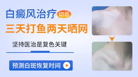 女生的隐藏部位白癜风怎么治