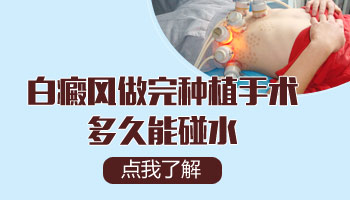 身上白块做了移植手术多久能碰水