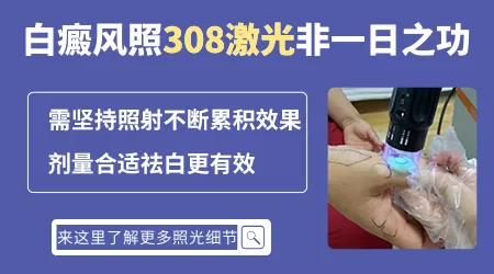 治疗白癜风308准分子激光治疗仪