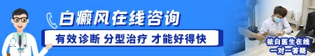 白癜风和其他白斑图片对比