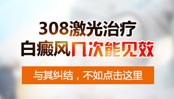 308激光治疗白癜风几周见效