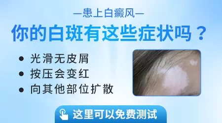皮肤变白是什么皮肤病