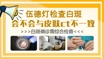 女子腹股沟白斑 女性白斑的原因