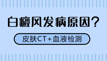 嘴角有一点白癜风能查出病因吗