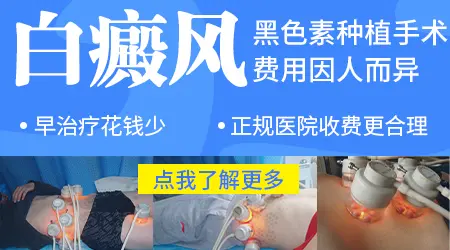 黑色素细胞种植治白斑多少钱
