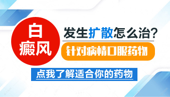 儿童白癜风扩展期如何控制