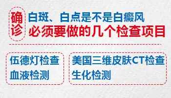 担心白斑是白癜风可以通过哪些方法判断