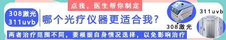 白癜风照308激光和uvb光效果对比