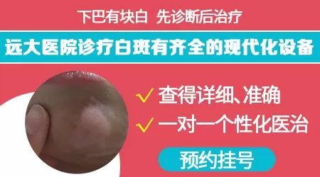 宝宝下巴皮肤白块