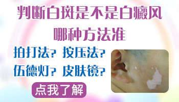 手背手腕和腿部有白点是不是白癜风