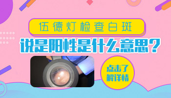 伍德灯检查阳性是白癜风吗