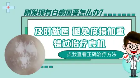 伍德灯检查白斑淡白色什么意思